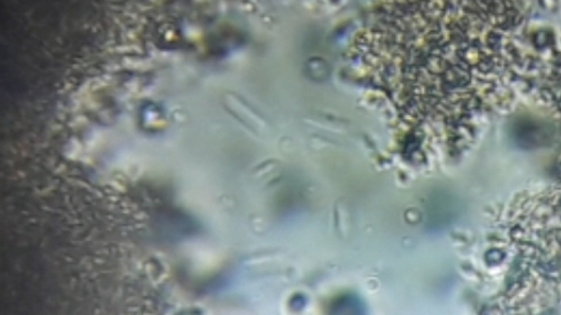 5. Sınıflarla Mikroskobik Canlılardan Yoğurt Yapan Bakterileri İncelenmesi